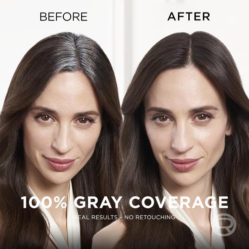 L’Oreal Paris Magic Root Cover Up Gray Concealer Spray, Medium Brown, 2 Oz(Packaging May Vary)